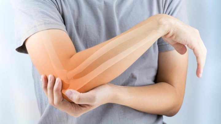 Everything you need to know about Plantar Fasciitis