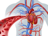Cardiologists in Treating Heart Attacks