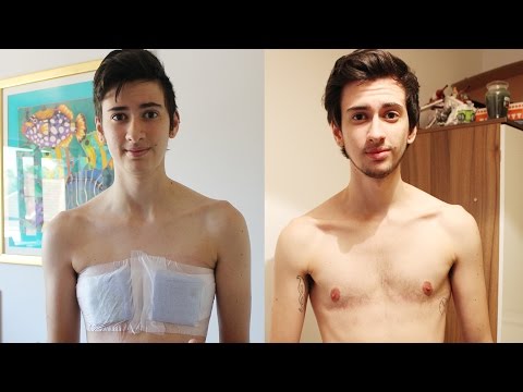 How much does it cost to transition from female to male?
