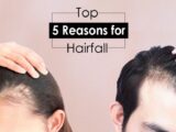 5 top reasons for hair loss