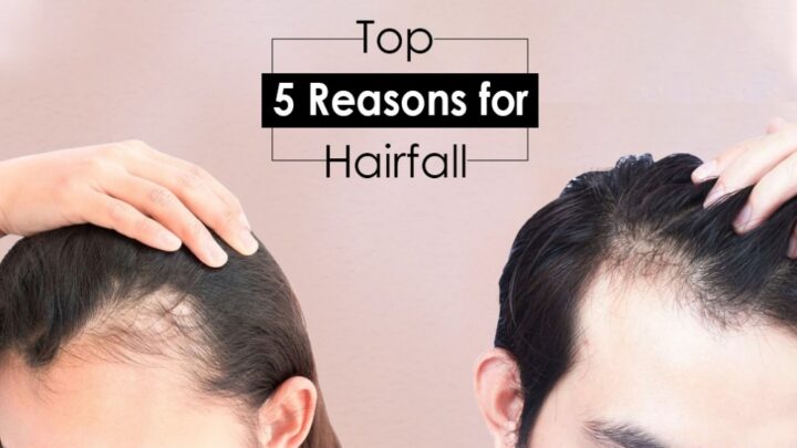 5 top reasons for hair loss