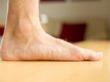 What kind of pain does flat feet cause?