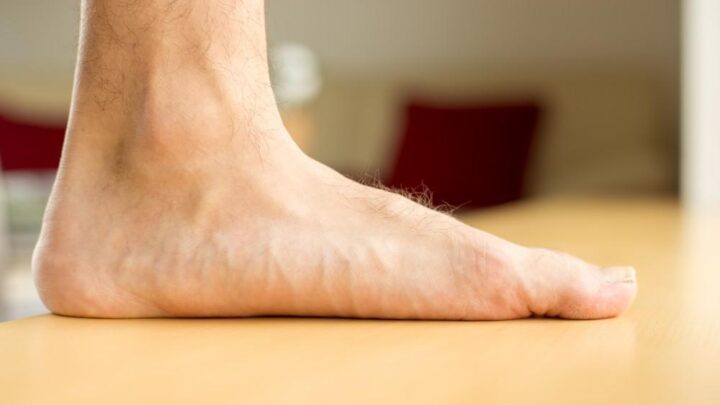 Flat Feet Pain Treatment & Symptoms